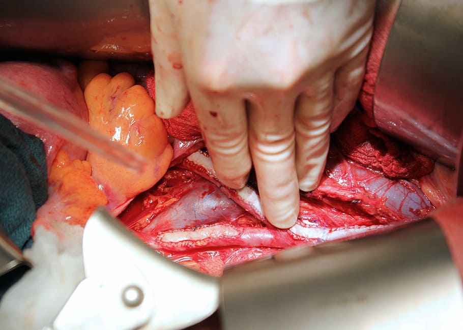 Vascular Surgeon In Lucknow | Dr. Jigar K Shah