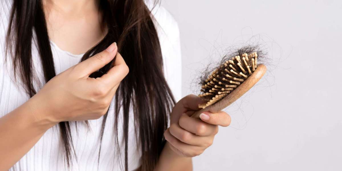 Haartransplantation Stuttgart Preis – Faire Kosten & Beratung vom Profi