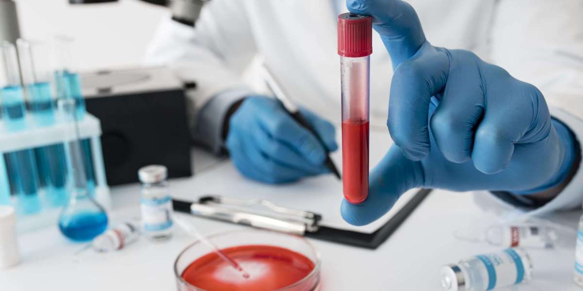 Affordable Blood Test in Bangalore: Trusted Diagnostic Services for Accurate Results