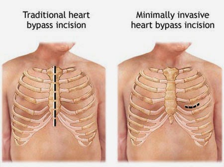 Interventional Cardiologists in Lucknow | Dr. Jigar K Shah