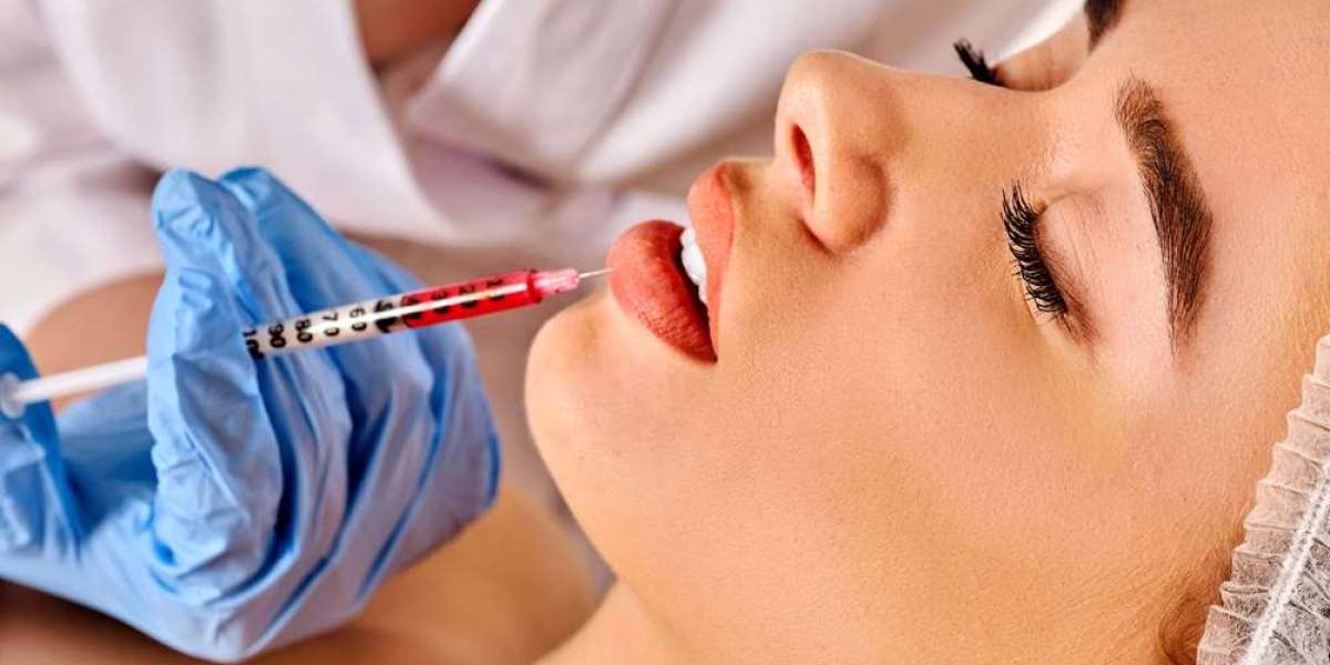 Hand Rejuvenation Using Dermal Fillers
