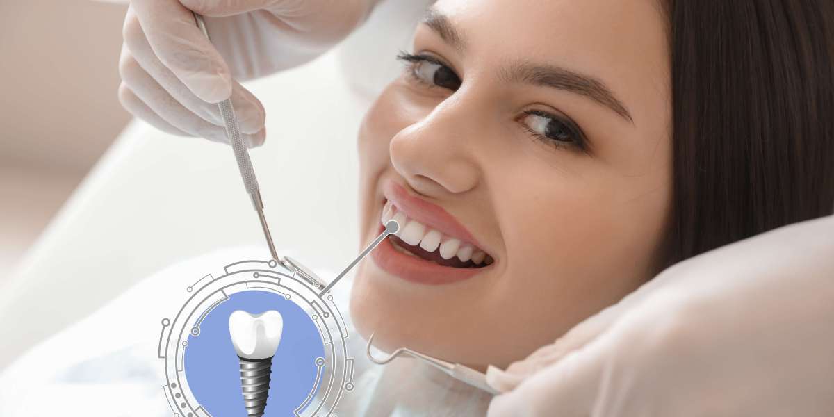 Lost a Tooth Without Warning? Here’s Your Urgent Response Guide