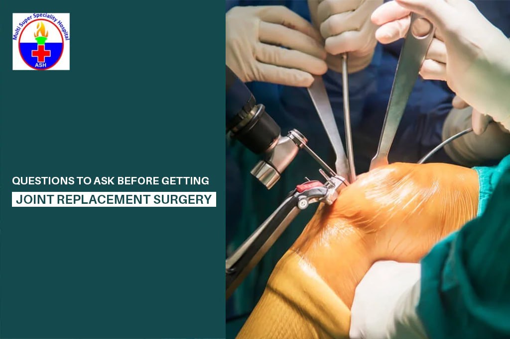Questions to Ask Before Joint Replacement Surgery | Patient Guide