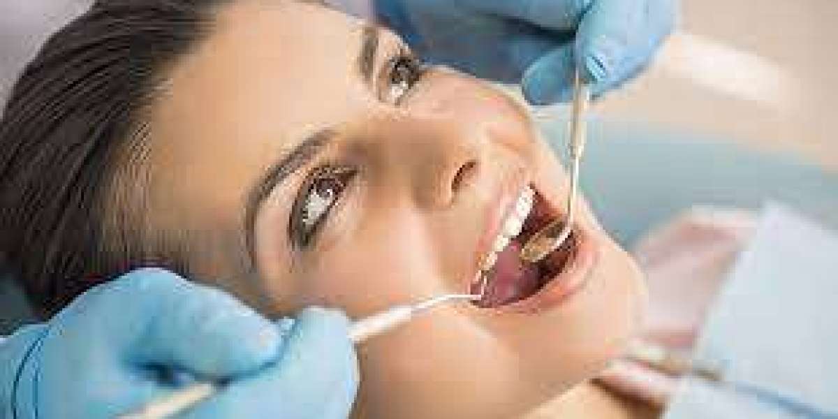 Composite Veneers in Brisbane: Enhance Your Smile with Confidence