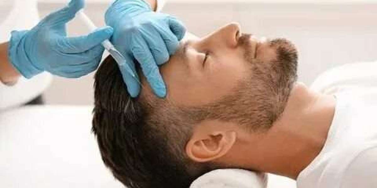 PRP Hair Treatment in Islamabad – Natural Hair Restoration