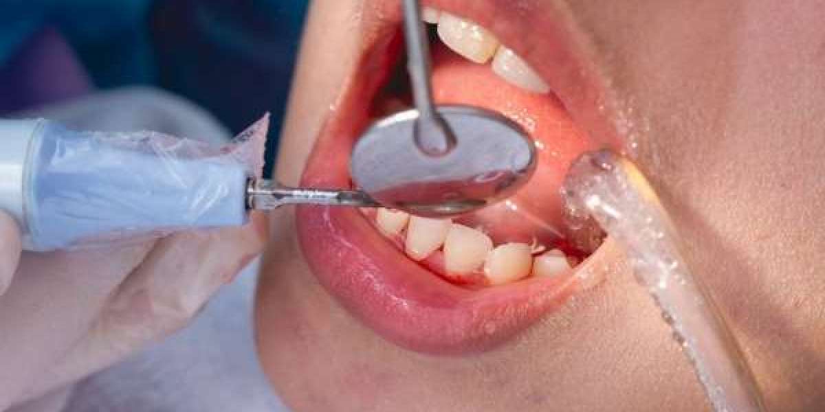 Nha Khoa Tốt Nhất Phú Thọ – Bí Quyết Chọn Đúng Địa Chỉ Cho Người Dân Địa Phương