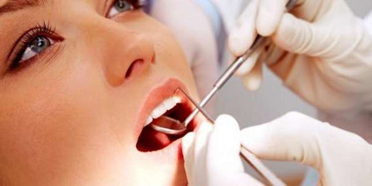 Lấy cao răng đúng chuẩn y khoa: Những điều bạn chưa từng được cảnh báo