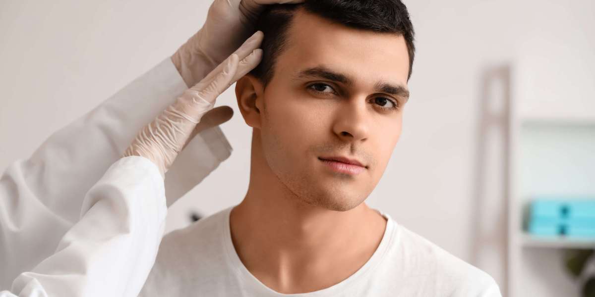 Why Dermatologists Recommend Exosome Hair Treatment