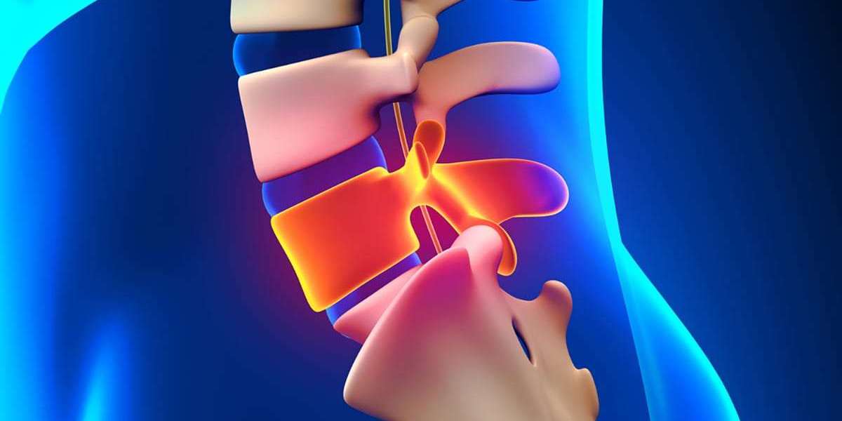 Exploring Options for Private Spine Surgery in Canada