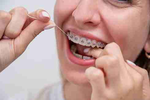 Image Source - teeth whitening Tottenham