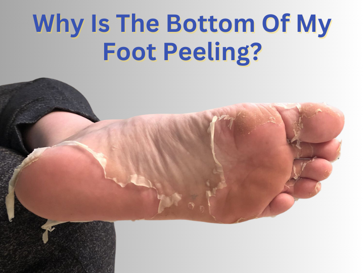 Why Is The Bottom Of My Foot Peeling? - Foot & Ankle Center of Arizona
