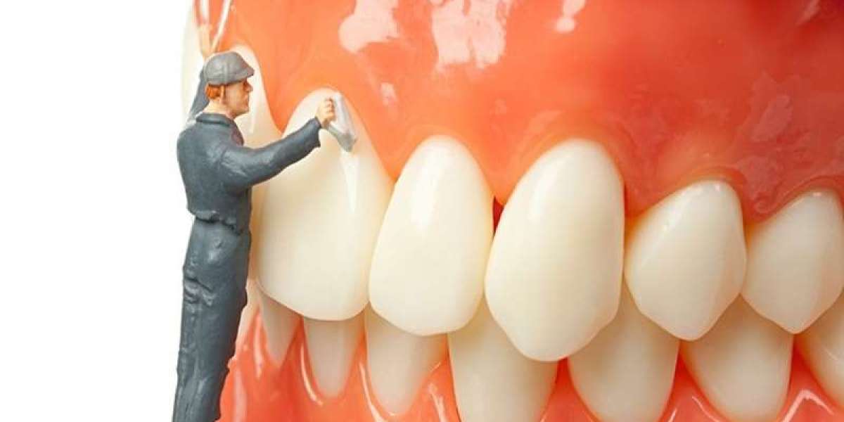 Trám răng – Lựa chọn thông minh để bảo vệ răng chắc khỏe 