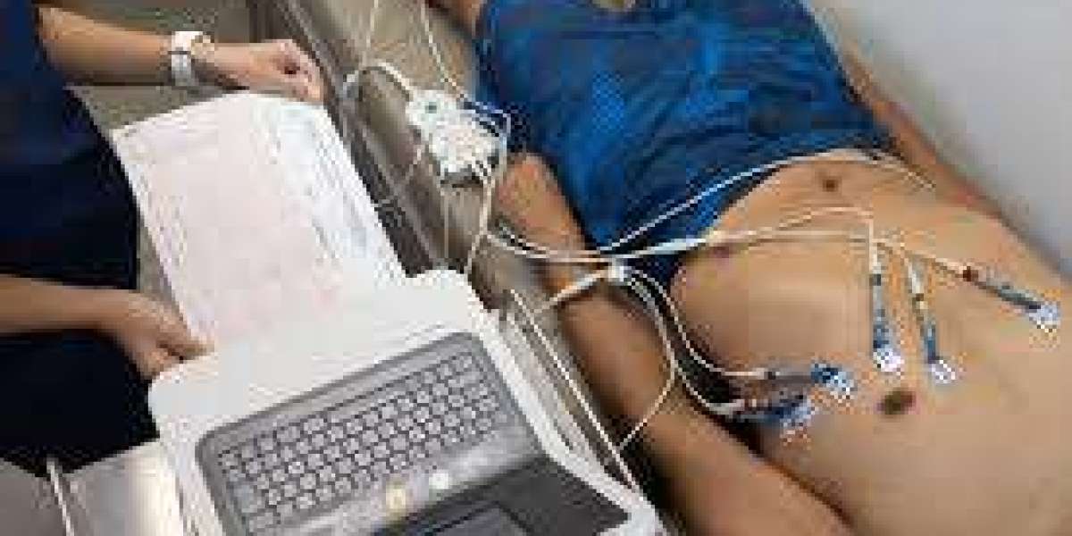 ECG Test Near Me: A Complete Guide to Heart Health and Diagnosis
