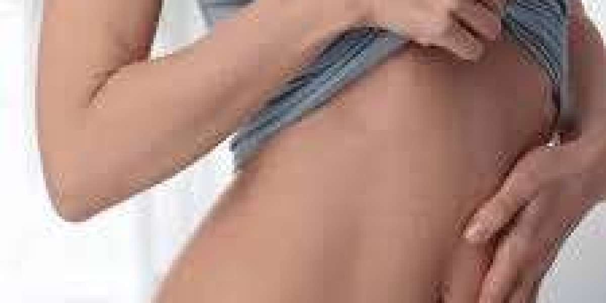 Liposuction for Women in Islamabad: Options & Expectations