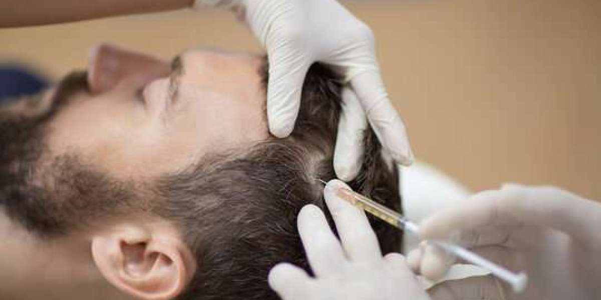 Best Clinic for Men’s PRP Hair in Islamabad