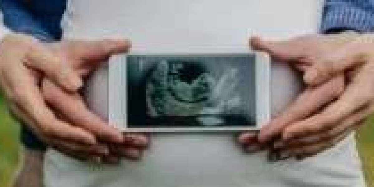 Best IVF Doctors in Gurgaon: Yellow Fertility and IVF Center You Can Trust