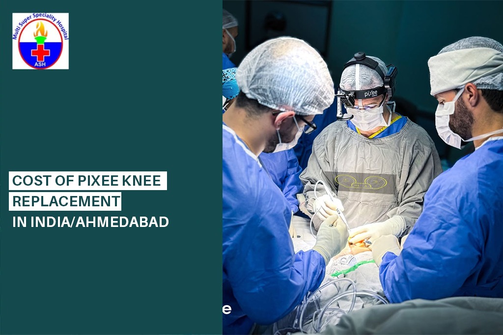 Cost of Pixee Knee Replacement in India/Ahmedabad - Dr Rishi Sanghvi