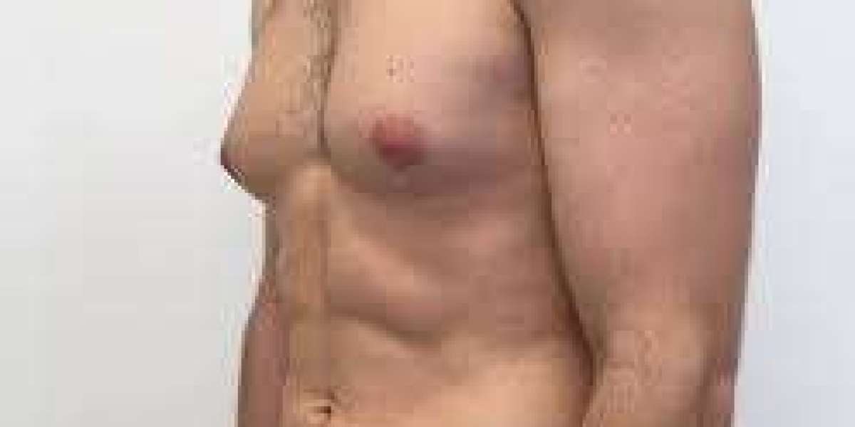 Transform Your Look with Breast Augmentation in Islamabad