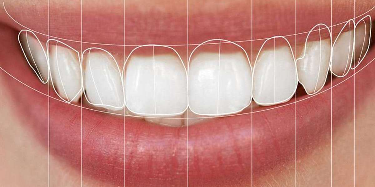 How Digital Smile Design Can Improve Your Restorative Dentistry Practice
