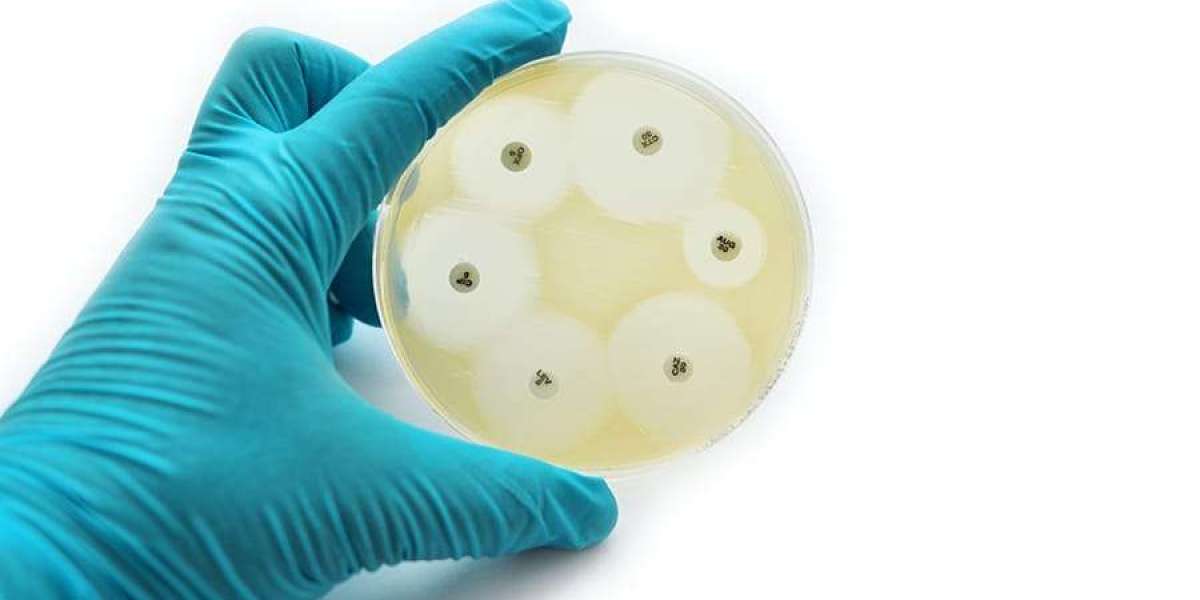 Antimicrobial Polymer Films Market Hindrances Affecting Adoption, Growth, and Global Industry Expansion