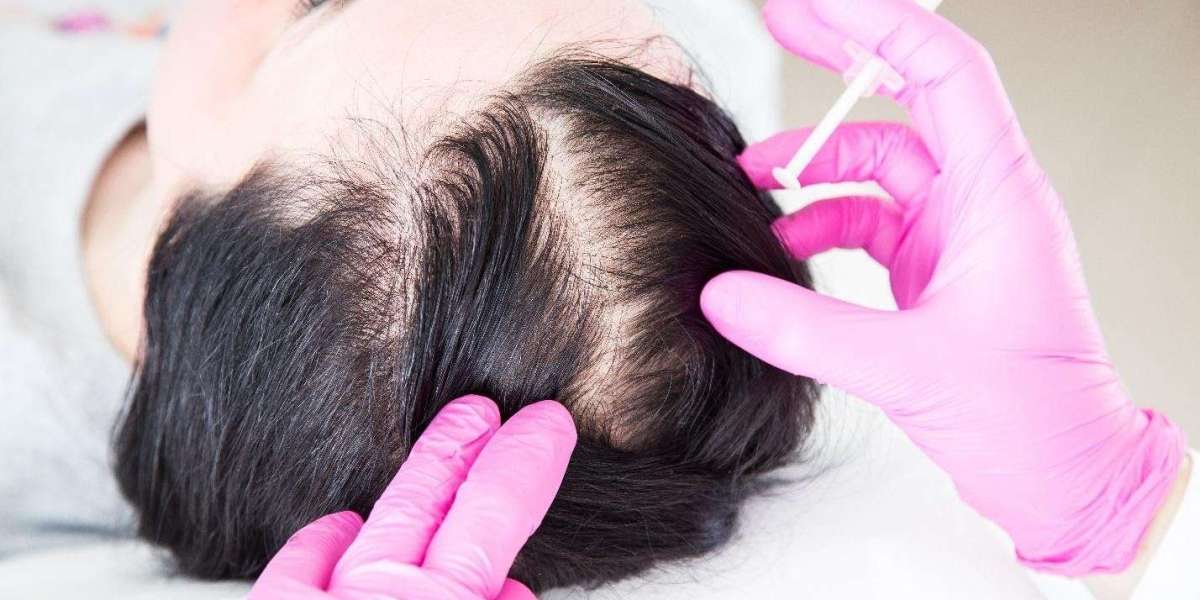 How PRP Therapy in Dubai Helps You Look and Feel Younger