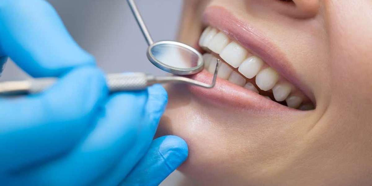 How Teeth Scaling in Islamabad Restores Natural Shine