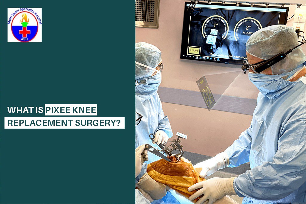 What Is Pixee Knee Replacement Surgery? - Dr Rishi Sanghvi