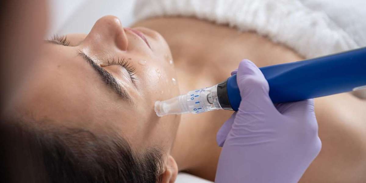 How Microneedling Treatment in Dubai Boosts Collagen for Youthful Skin
