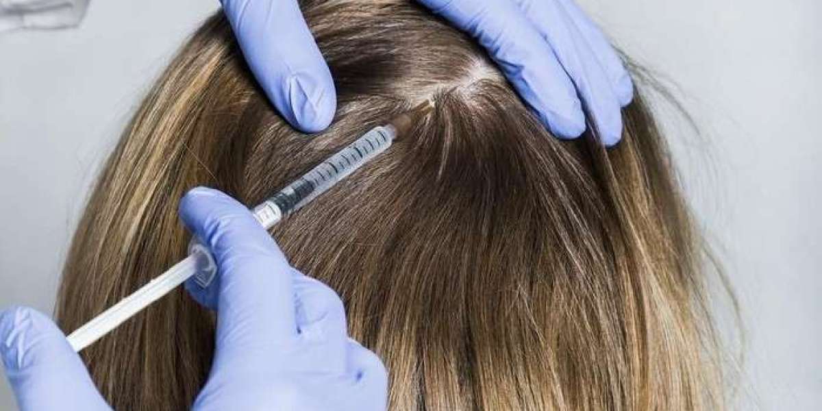 GFC vs Hair Transplant – Which Should You Choose?