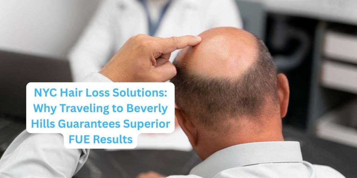 NYC Hair Loss Solutions: Why Traveling to Beverly Hills Guarantees Superior FUE Results