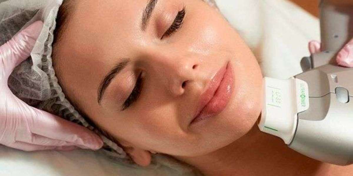 HIFU for Cheeks Lifting in Islamabad – Restore Firmness and Definition