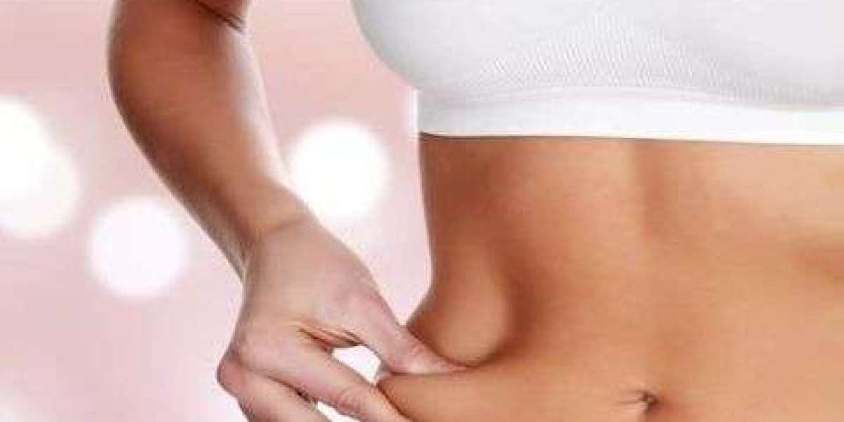 liposuction in Islamabad – A Safe Way to Get Rid of Excess Fat