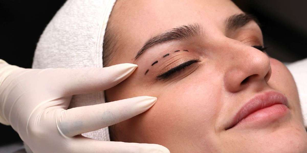 Eyelid Surgery in Islamabad – A Youthful Look for Your Eyes