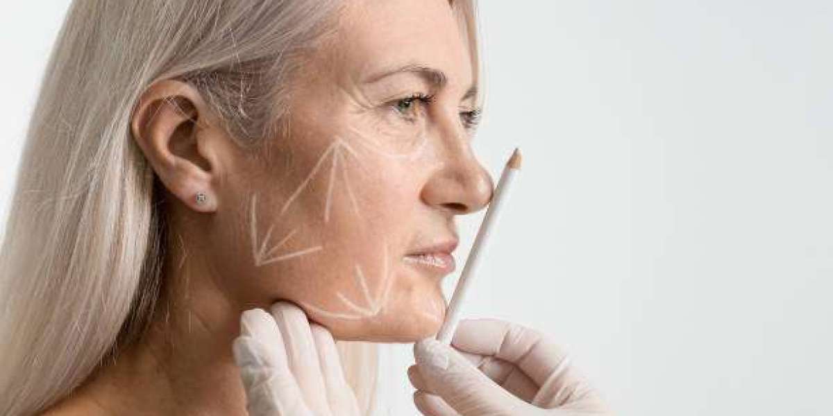 Top Surgeons for Facelift in Islamabad: 2025 Guide