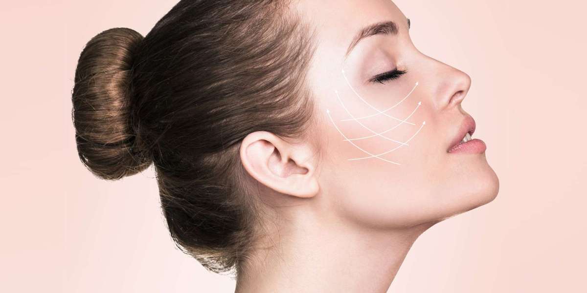 Achieve a Snatched Jawline Without Surgery