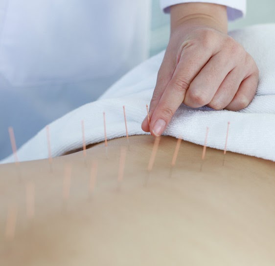 Discover the Power of Natural Healing: The Best Detox and Acupuncture Therapies in RR Nagar
