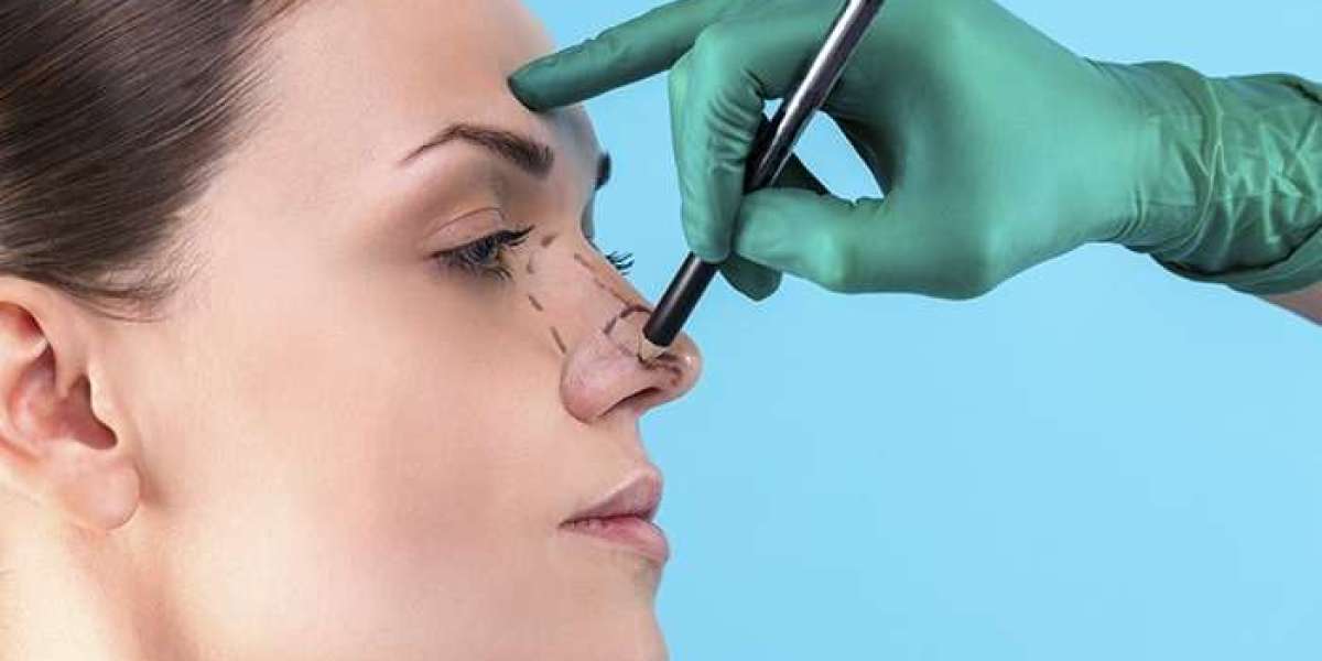 فوائد جراحة تجميل الأنف للمظهر والثقة بالنفس