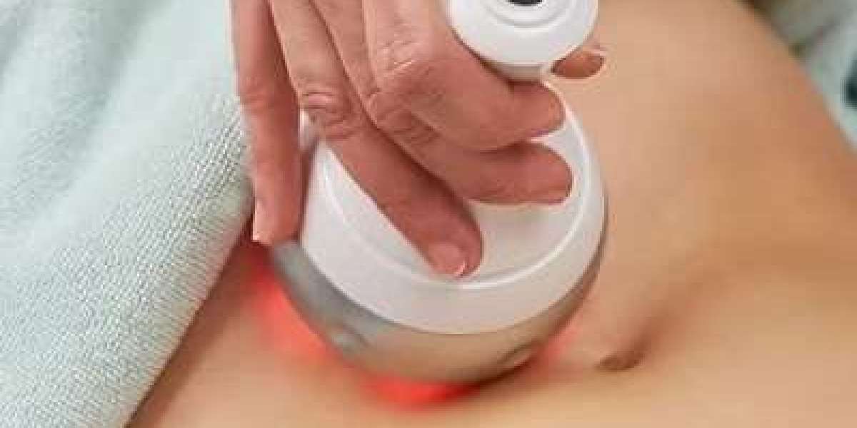 The Evolution of Modern Body Contouring Techniques
