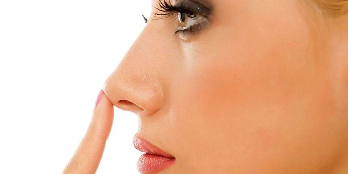 FAQs About Rhinoplasty in Islamabad Answered by Experts
