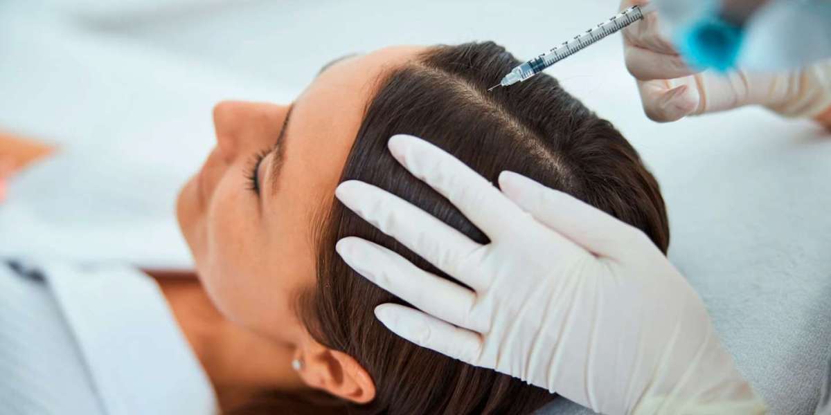 Can Women Get PRP Hair Treatment for Hair Thinning?