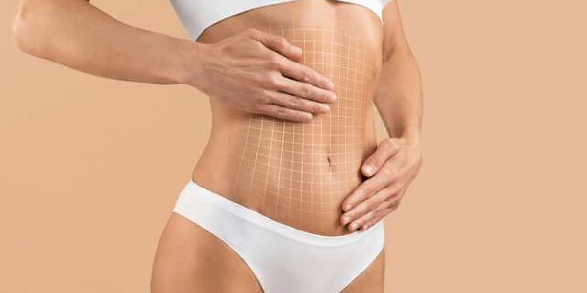 Full Body Liposuction in Islamabad: Pros and Cons