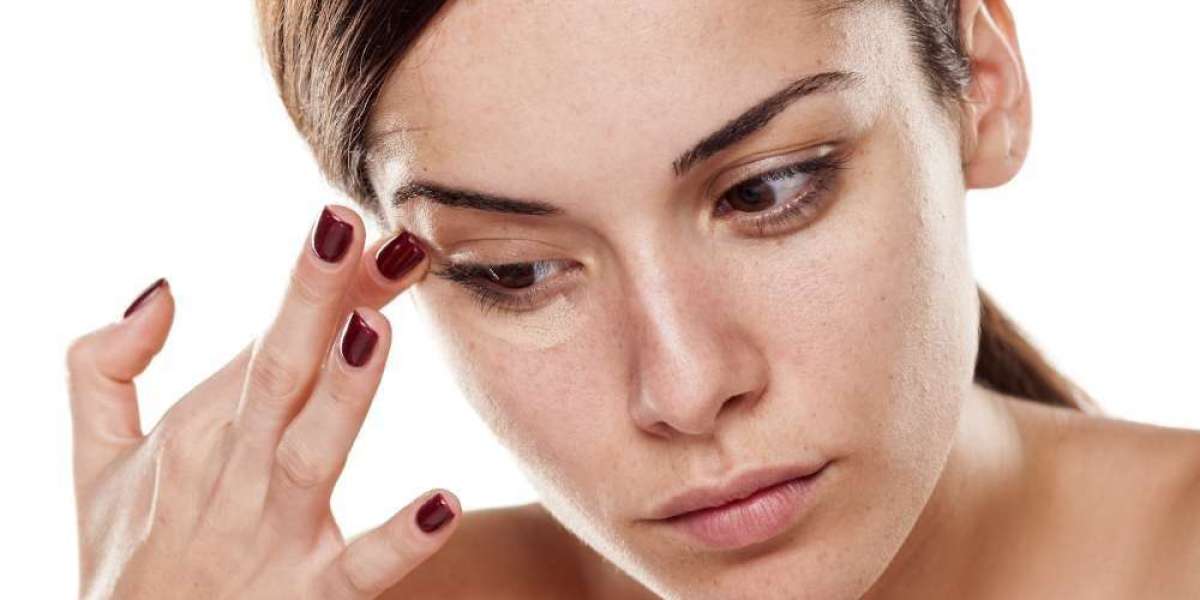How Many Sessions Are Needed for Dark Circles Treatment?