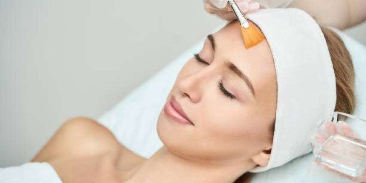 Common Mistakes People Make After a Chemical Peel