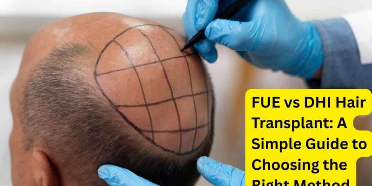 FUE vs DHI Hair Transplant: The Ultimate SEO-Friendly Comparison Guide