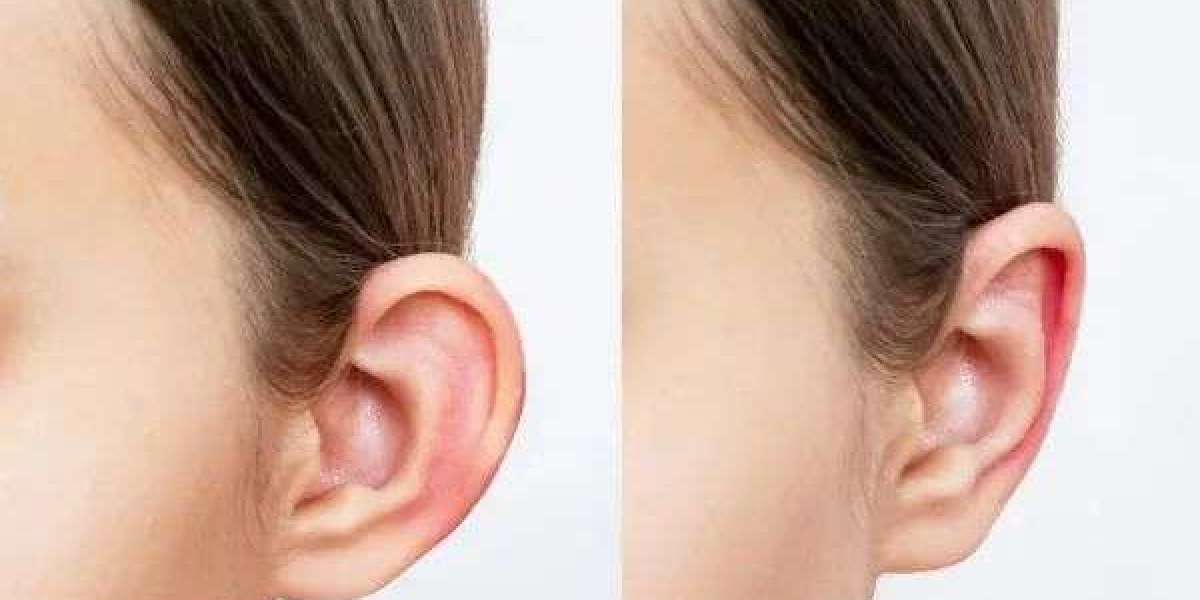 Affordable Ear Reshaping in Islamabad
