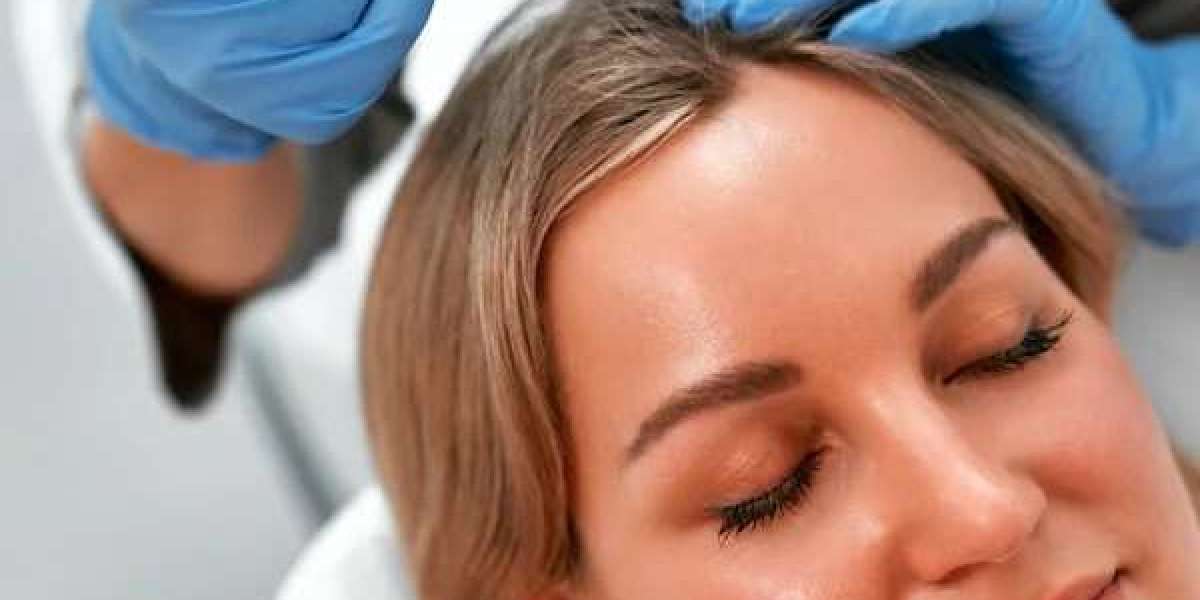 PRP for Women: Hair Thinning Solutions in Islamabad