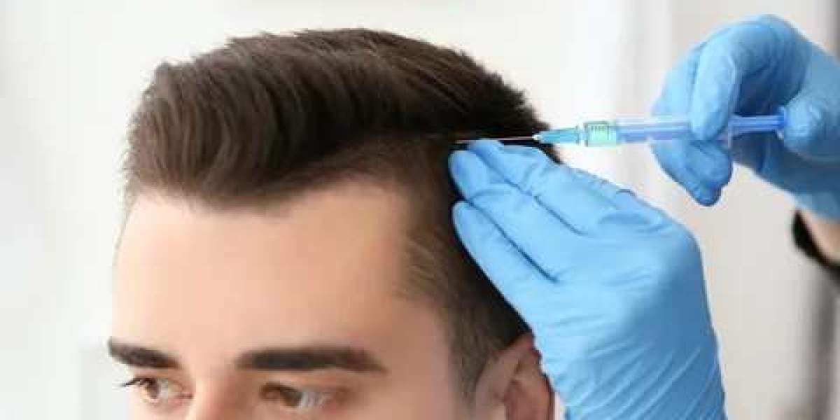 Understanding Hair Loss Treatments in Islamabad: Transplants and Beyond