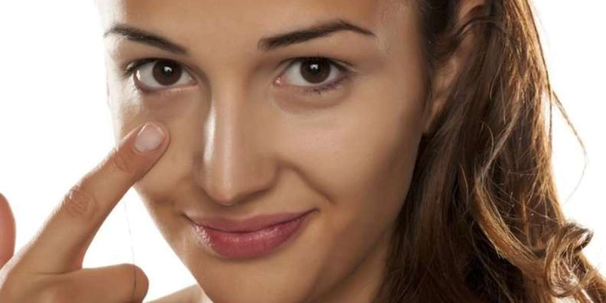 Are Non-Invasive Dark Circle Treatments Worth It?