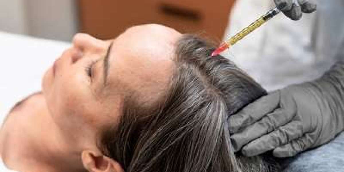 Why Exosome Therapy is Safer Than Traditional Hair Transplants in Riyadh