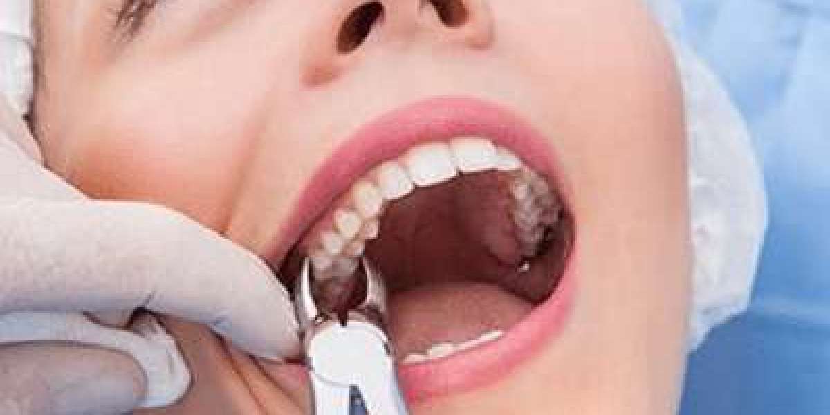 Tooth Extraction Aftercare in Islamabad – Complete Healing & Recovery Guide